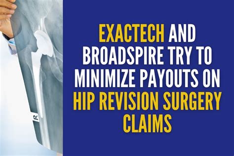 ezectech|exactech hip recall.
